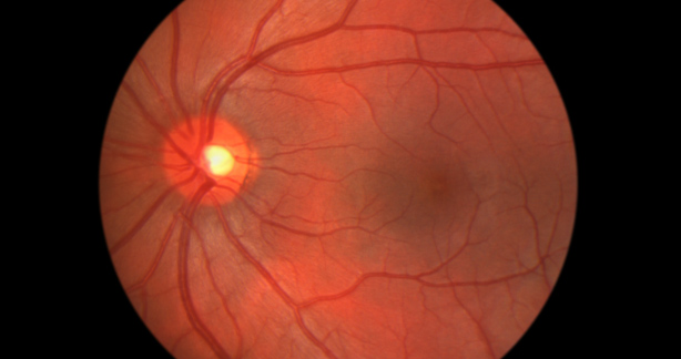 Esame del fundus oculi